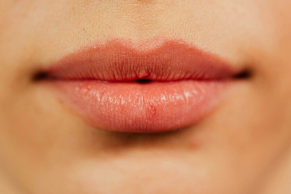 Lips