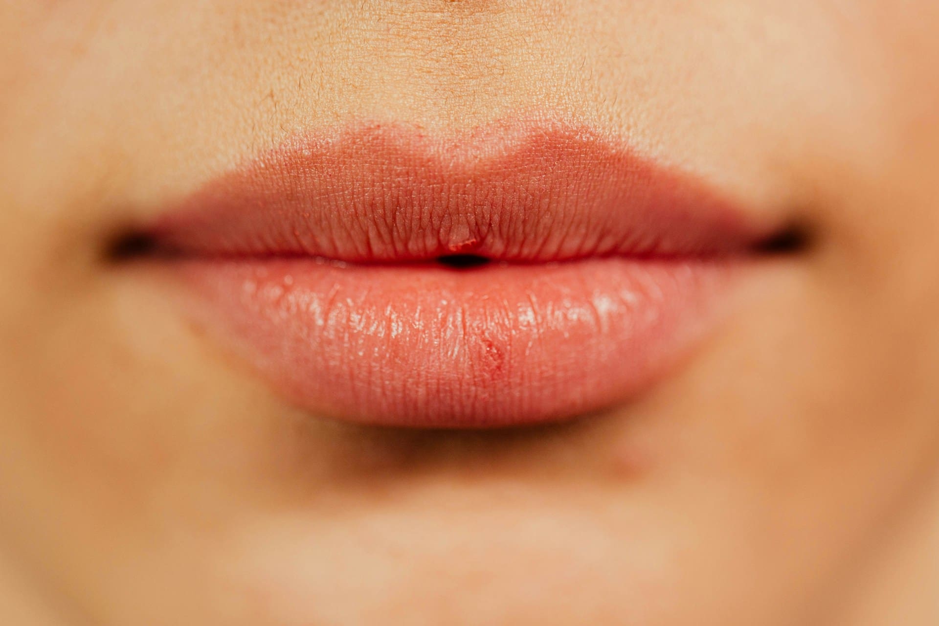 Lips